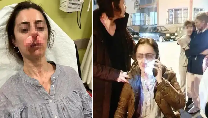 Otomobil Kapısı Silah Sayıldı: Eşinin Sevgilisi Zannettiği Kişiye Saldırdı