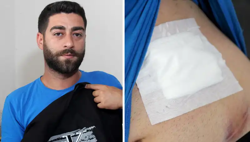 Karnındaki Ağrıdan Korkan Kadının Röntgeni Şok Etti
