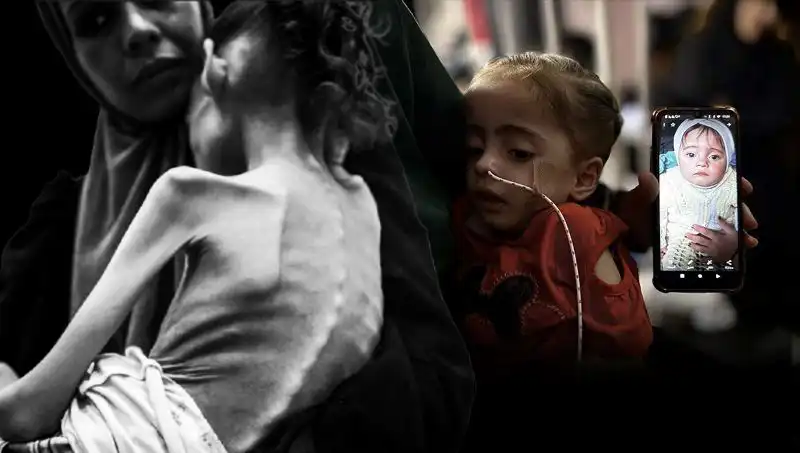 25 Kilodan 10 Kiloya Düşen Küçük Meryem’in Açlıkla Mücadelesi